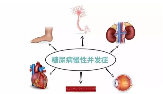 血糖波動(dòng)大，并發(fā)癥來得快，糖友要多補(bǔ)硒